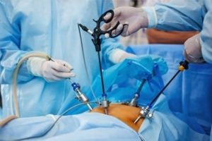 laparoscopy products