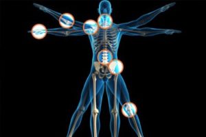 orthopedic products