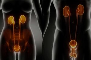 urology surgical products