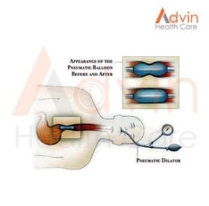 Achalasia Balloon Dilator