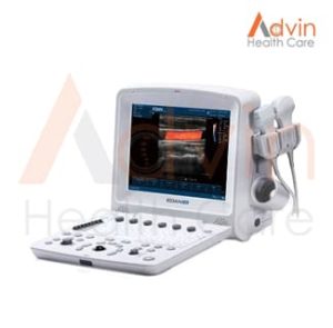portable-ultrasound-machine