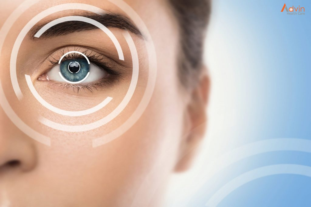 LASIK Eye Surgery