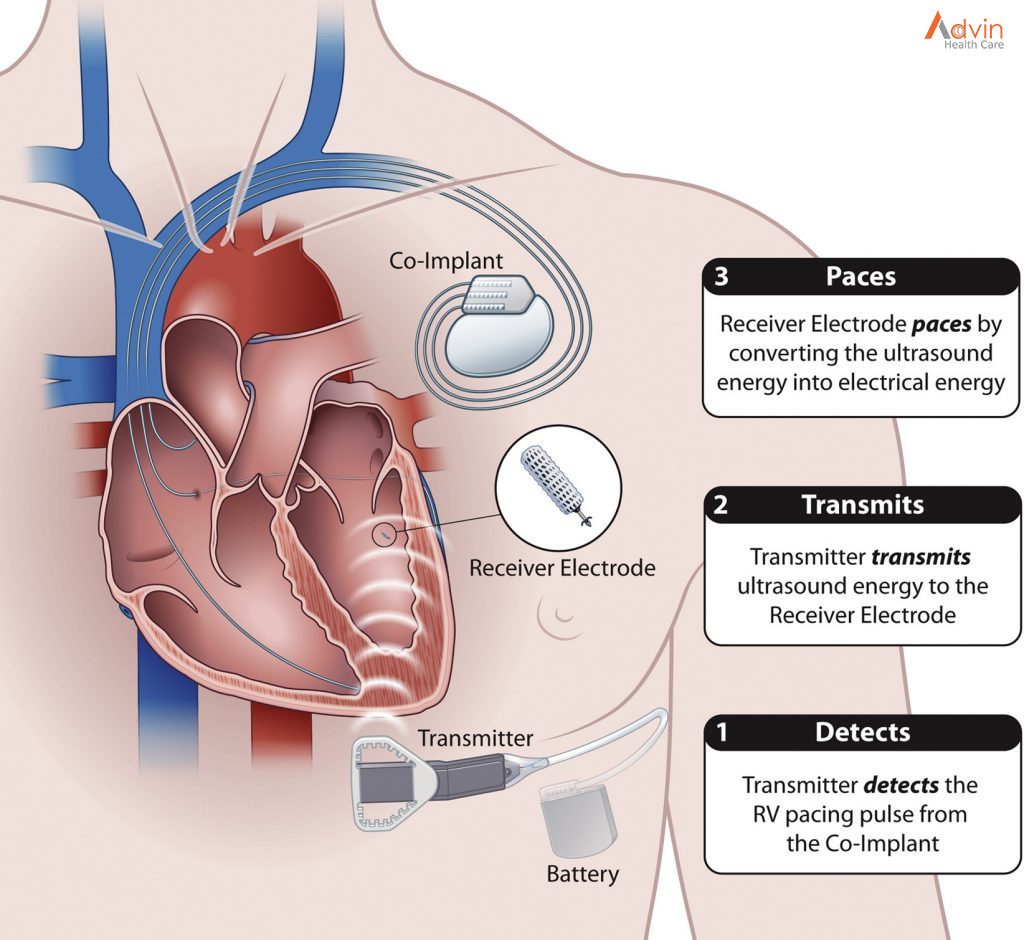 Heart Attack and Sudden Cardiac Arrest Differences – AdvinHealthcare %