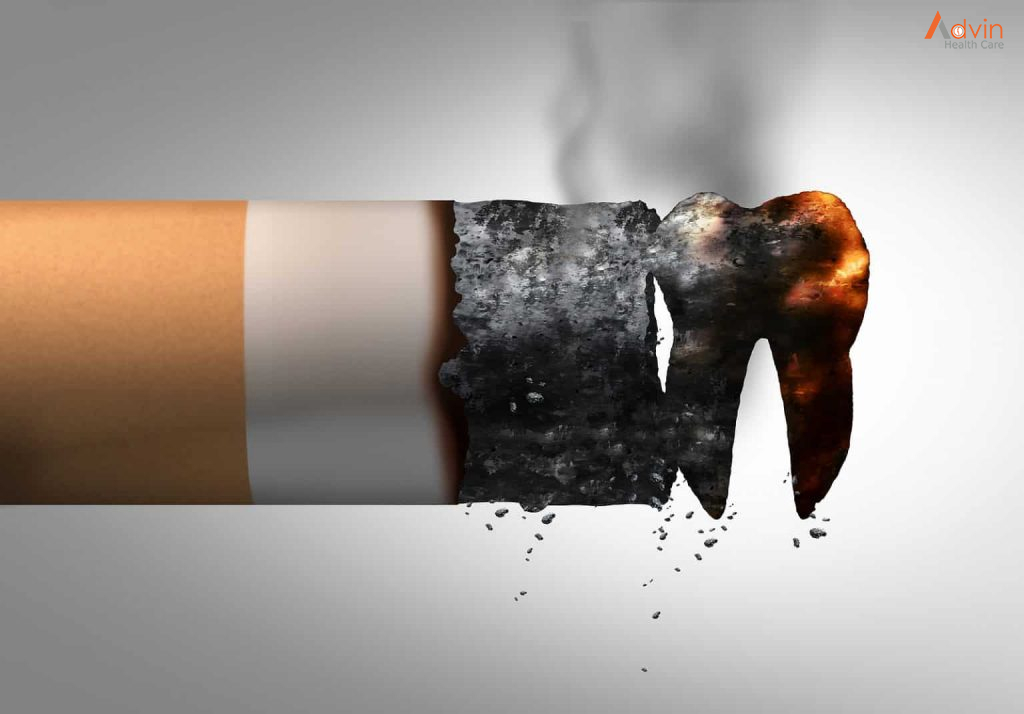 Tobacco and Dental Health