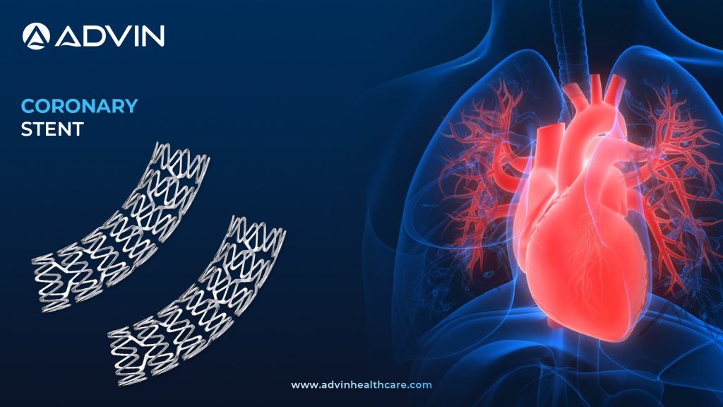 Cardiovascular Coronary Stents for Life-Saving Precision