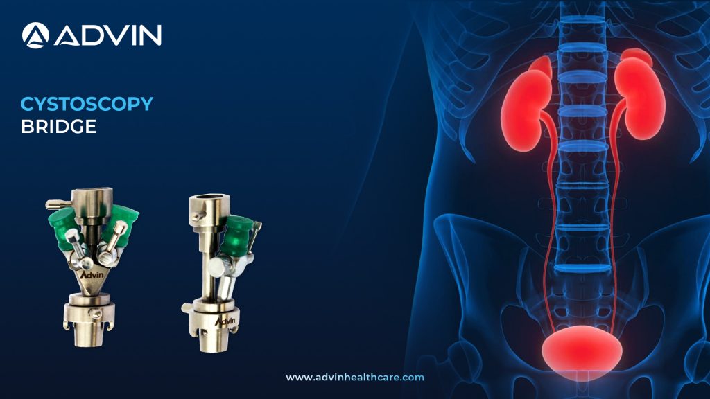 Cystoscope Bridge – A Crucial Connector in Cystoscopy Procedures