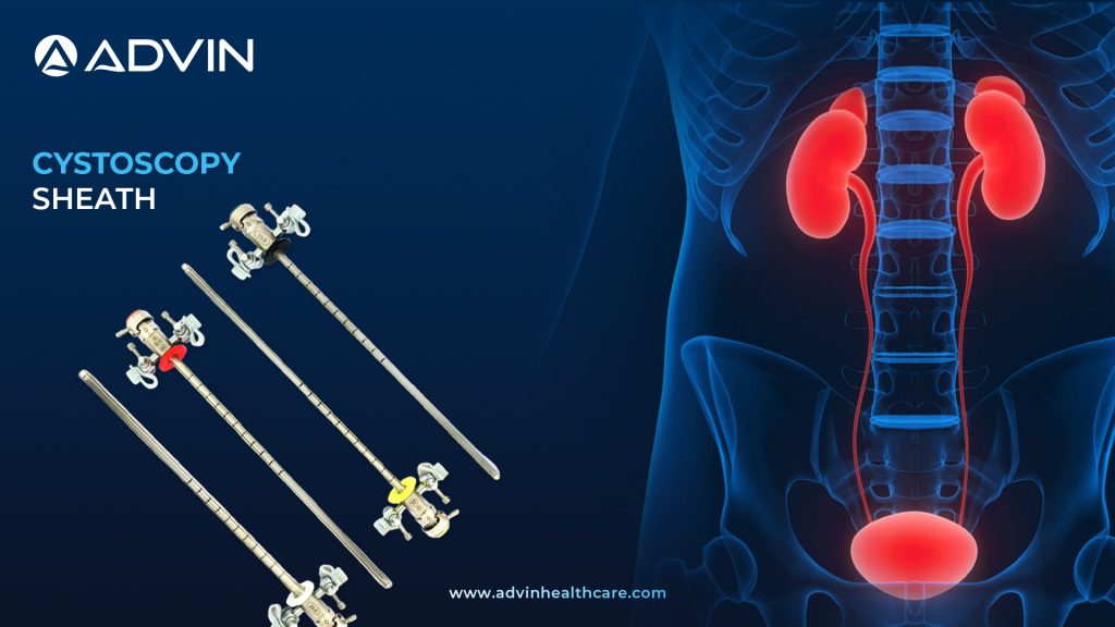 Cystoscope Sheath – A Vital Accessory in Diagnostic Cystoscopy