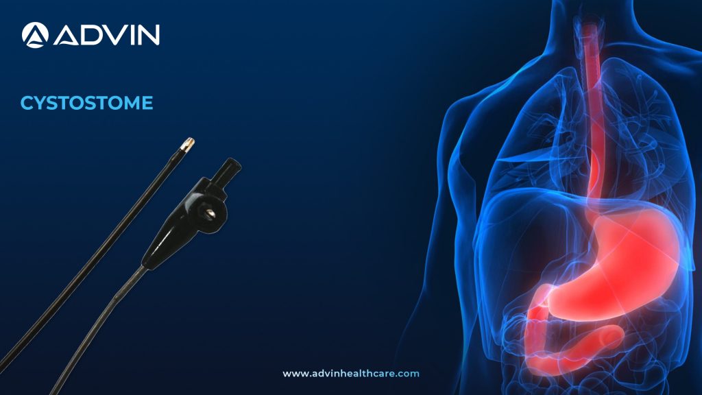 Cystostome – A Vital Endoscopic Tool