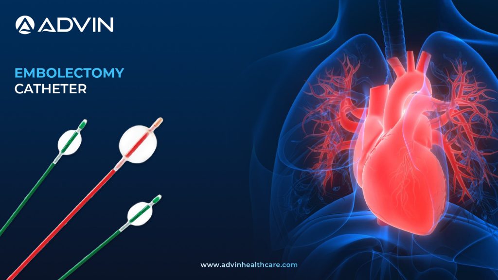 Embolectomy Catheter – Clot Removal Device for Cardiovascular Procedures