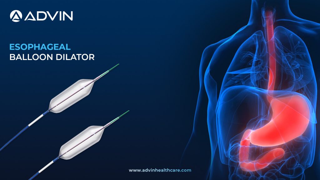 Understanding the Esophageal Balloon Dilator