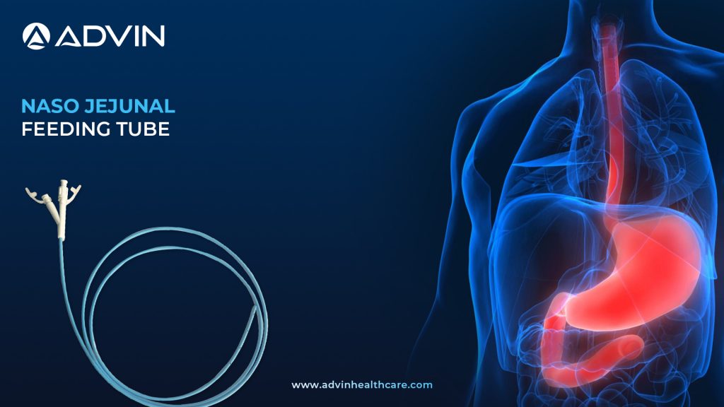 Naso Jejunal Feeding Tube – Supporting Safer Nutrition Delivery