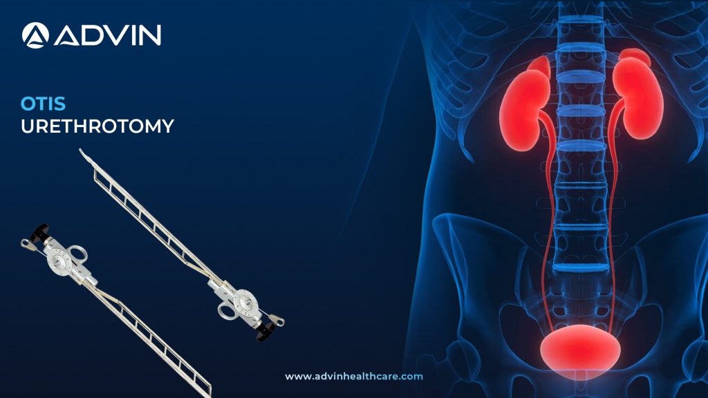 OTIS Urethrotome – A Precision Instrument in Urethral Surgery