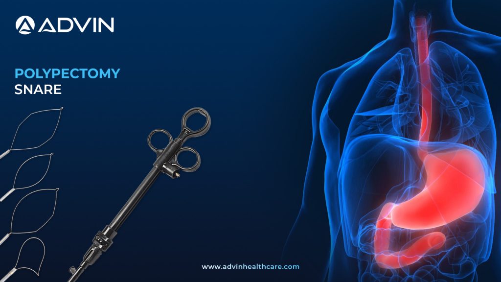 Polypectomy Snare – Essential Tool for Gastrointestinal Procedures