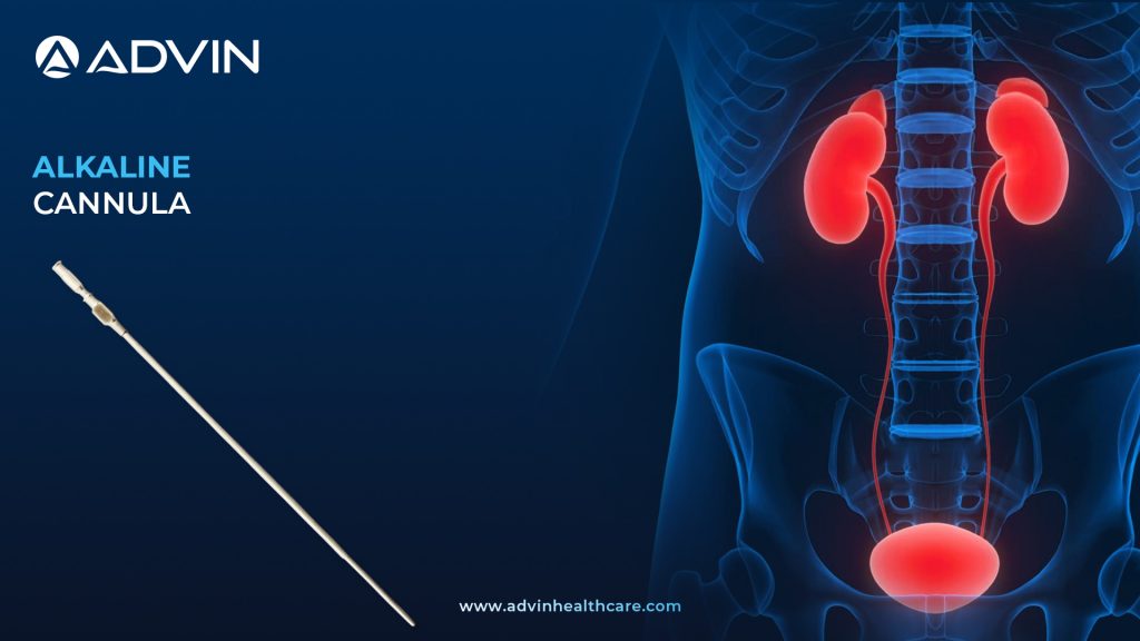 Alkaline Cannula – Engineered for Consistent Delivery and Patient Comfort