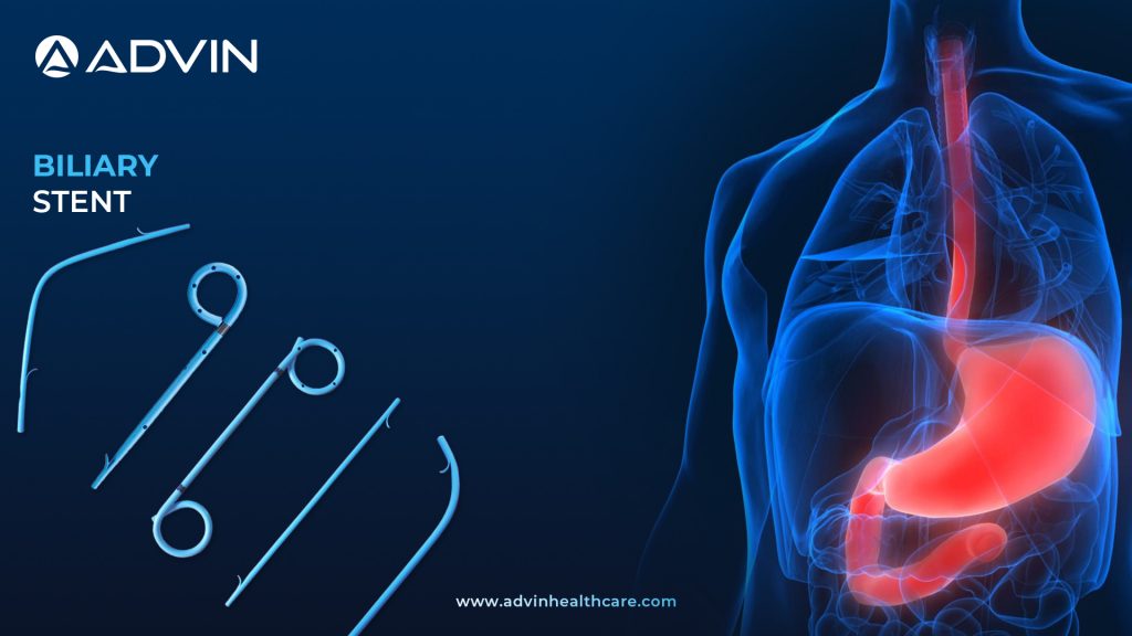 Biliary Stents – Applications and Benefits in Gastroenterology