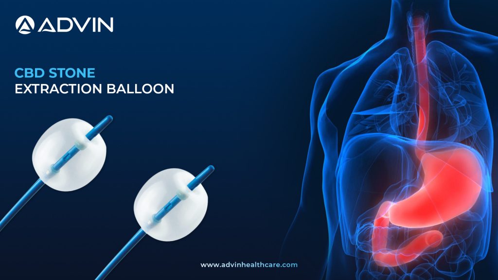 CBD Stone Extraction Balloon – A Safe, Reliable Tool for ERCP Stone Removal