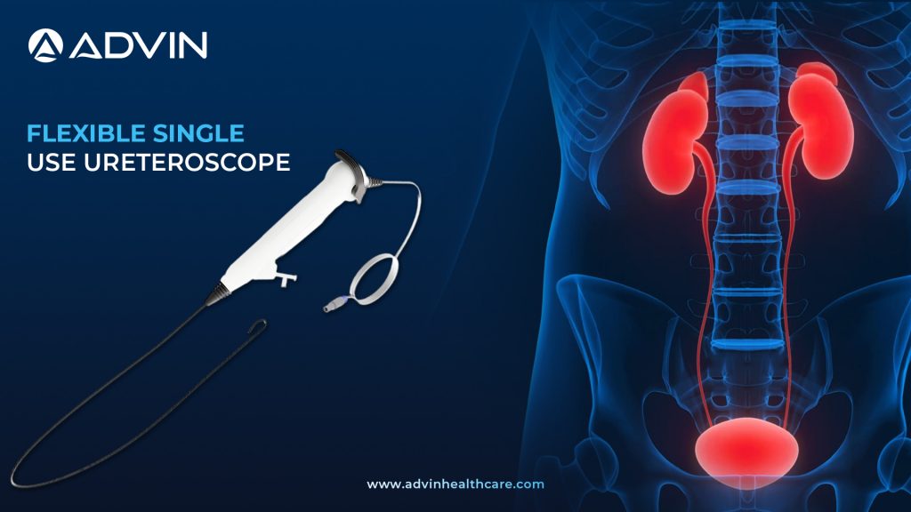 Flexible Single Use Ureteroscope – Hassle-Free Flexibility with Every Procedure