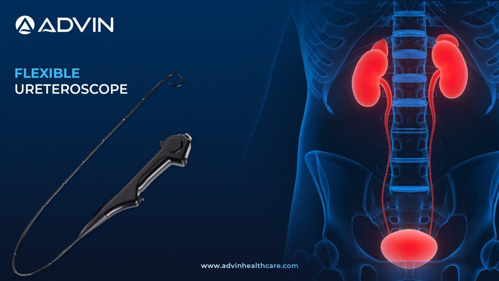 Flexible Ureteroscope – Flexibility Meets Clarity for Advanced Endourology