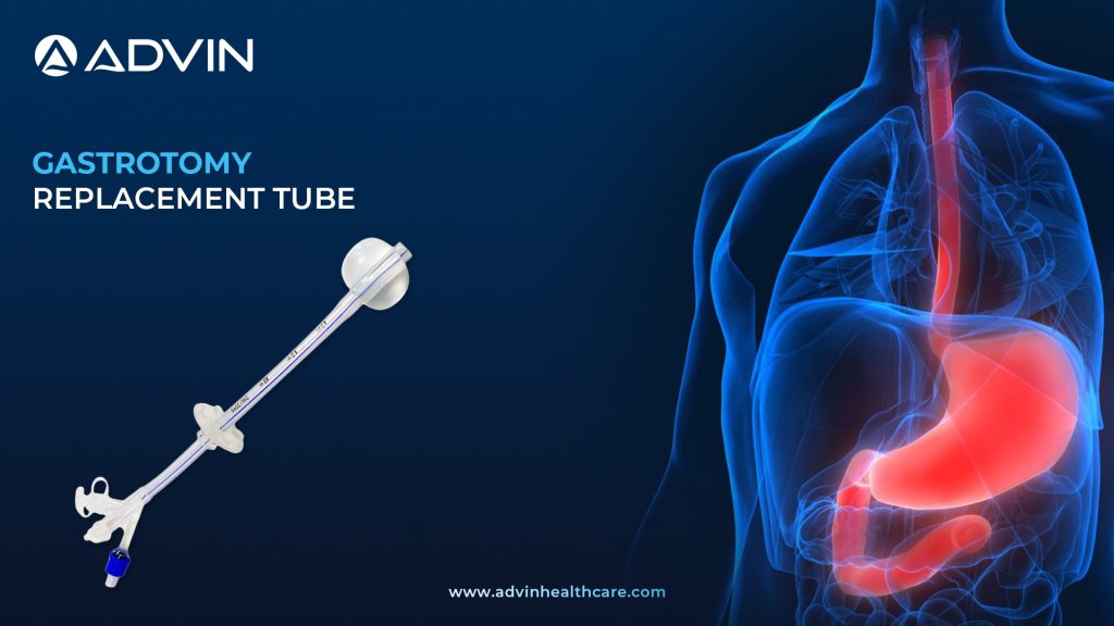 Gastrostomy Replacement Tubes in Modern Enteral Nutrition Care