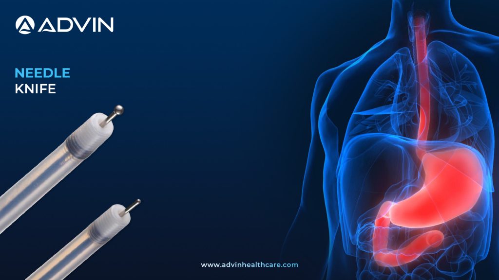 Needle Knife in ERCP – Precision Access for Complex Biliary Procedures