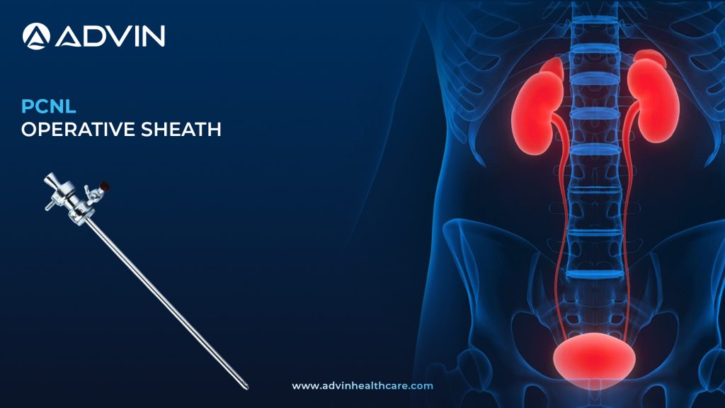 PCNL Operative Sheath – Essential Access Tool for Percutaneous Stone Surgery