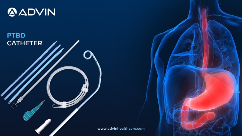 PTBD Catheter – Minimally Invasive Drainage for Complex Biliary Conditions