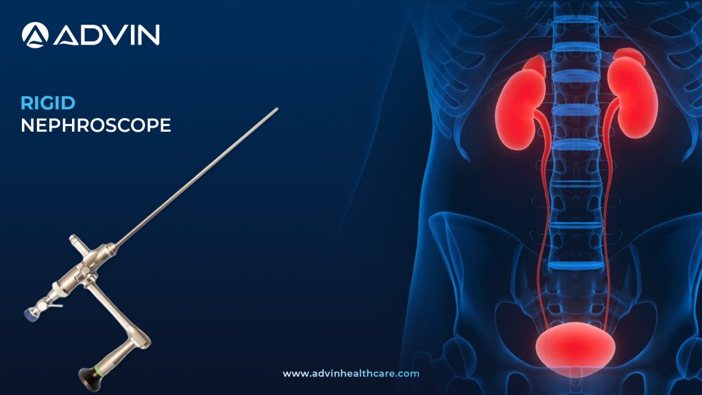  Rigid Nephroscope – Engineered for Accurate Navigation and Efficient Lithotripsy