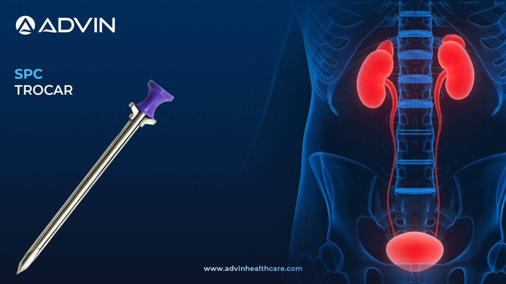 SPC Trocar – Essential Tool for Safe Suprapubic Catheterization