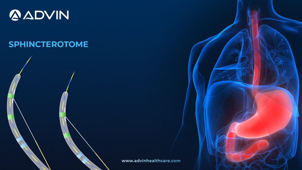 Sphincterotome in ERCP – An Important Tool for Biliary Access by Advin Health Care