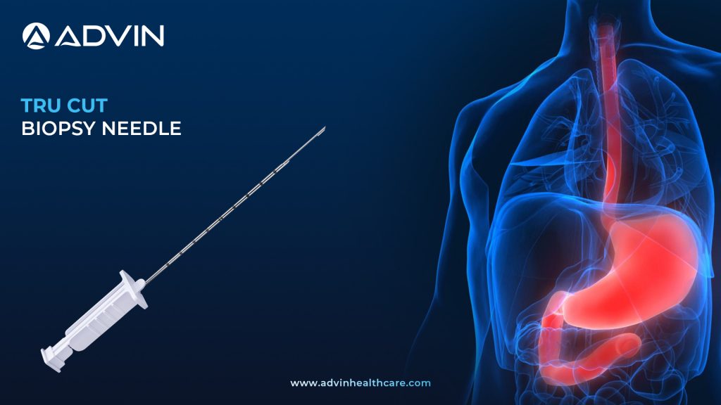 Advin Tru Cut Biopsy Needle – A Trusted Tool for Accurate Tissue Diagnosis