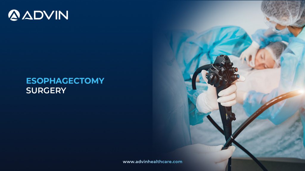 Understanding Esophagectomy – Procedure, Purpose & Progress