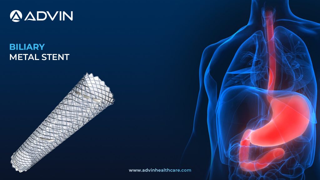 Biliary Metal Stent – Long-Term Patency for Bile Duct Obstruction