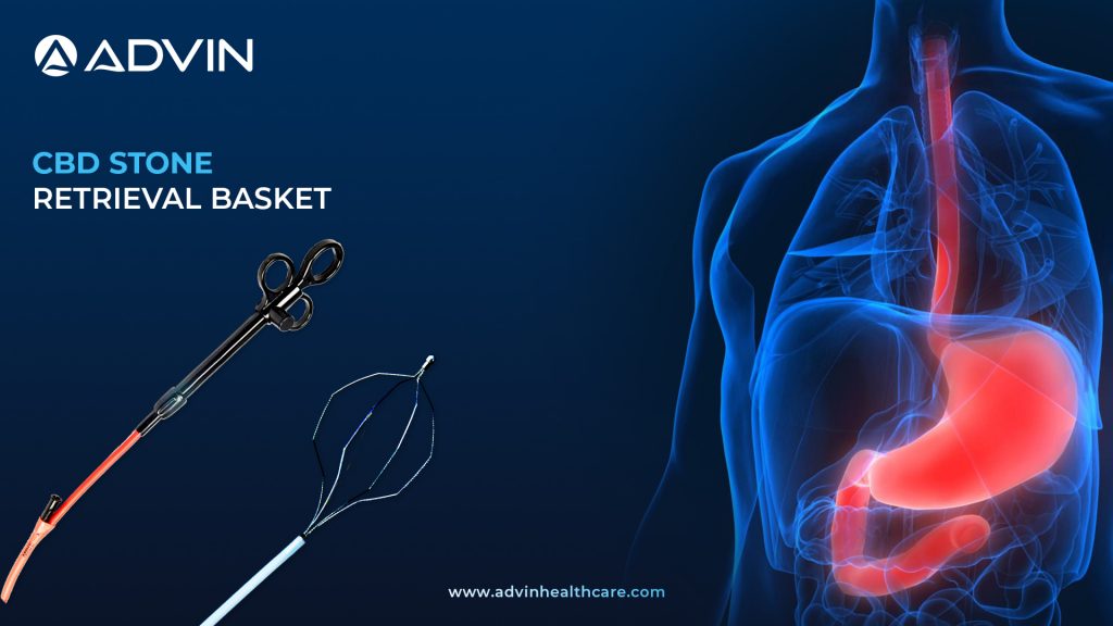 CBD Stone Retrieval Basket – Reliable Solution for Bile Duct Clearance