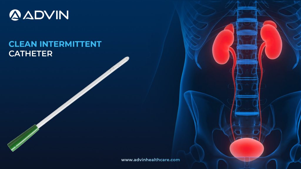 Clean Intermittent Catheter (CIC) – A Safe and Convenient Solution for Bladder Emptying