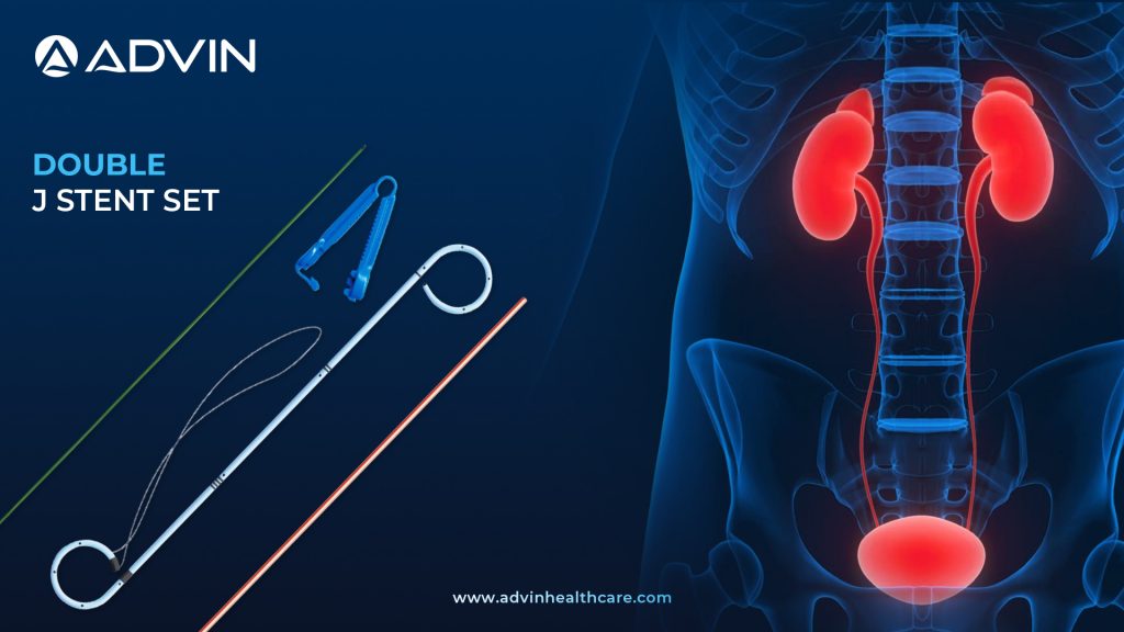 Double J Stent Set – Complete Solution for Ureteral Drainage and Support