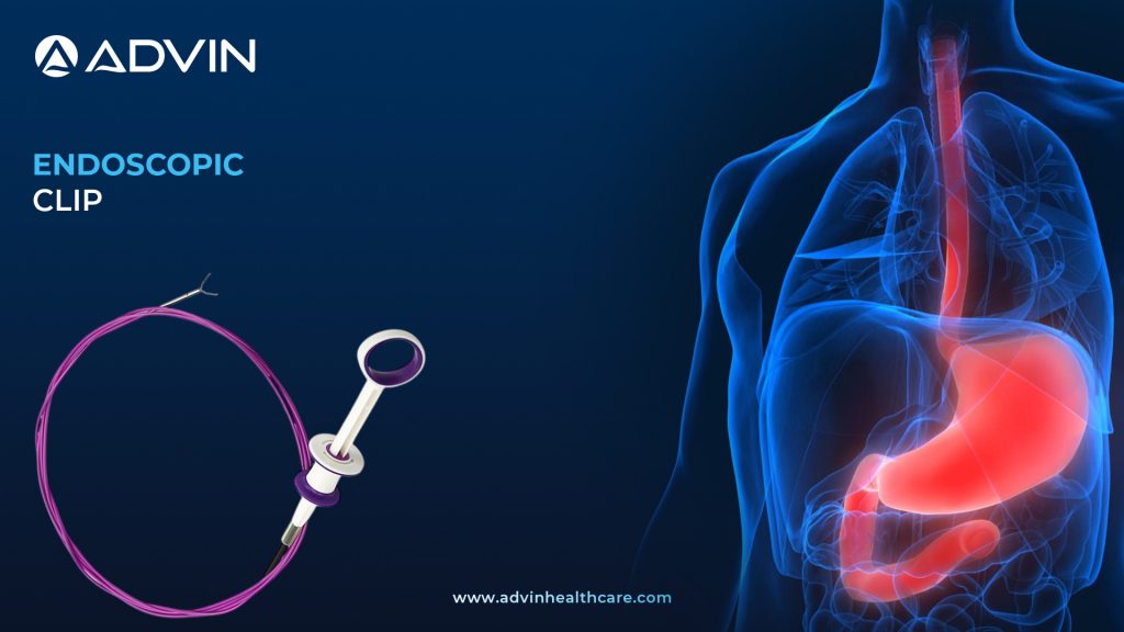 Endoscopic Clip – Advanced GI Clipping Solutions by Advin
