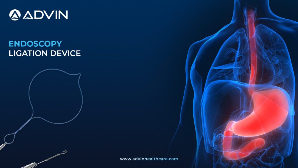 Modern Tools for Variceal Hemostasis – Endoscopy Ligation Device Explained