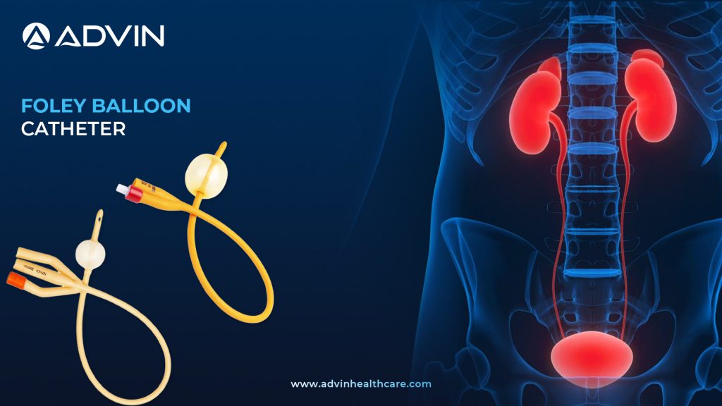 Foley Balloon Catheter – Trusted Solution for Long-Term Urinary Drainage