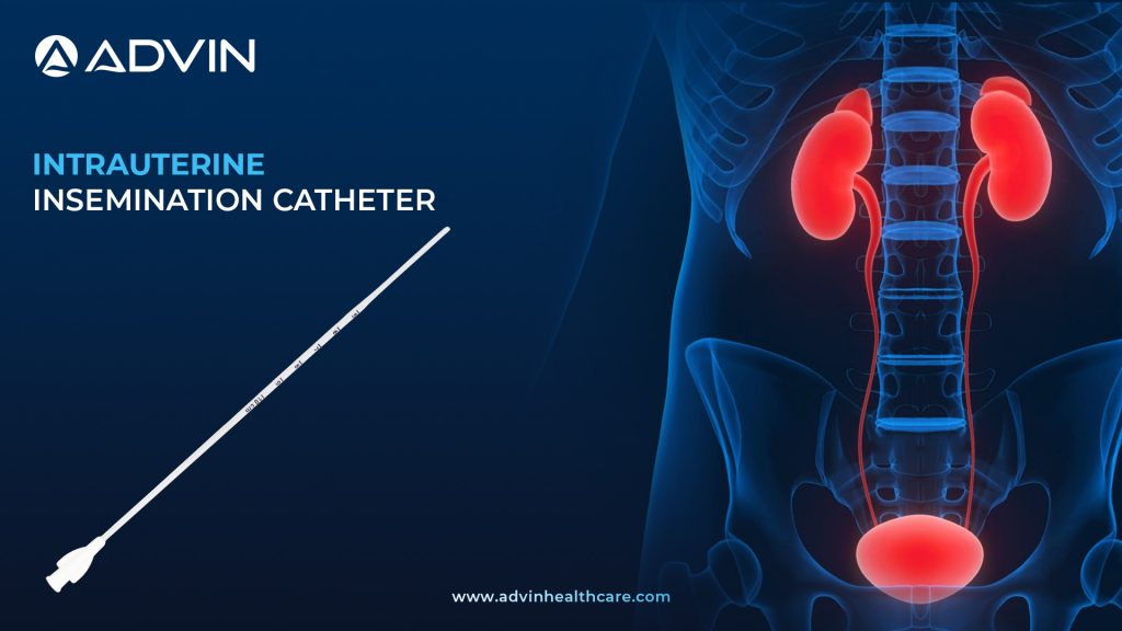 Intrauterine Insemination (IUI) Catheter – Precision Tool for Fertility Procedures