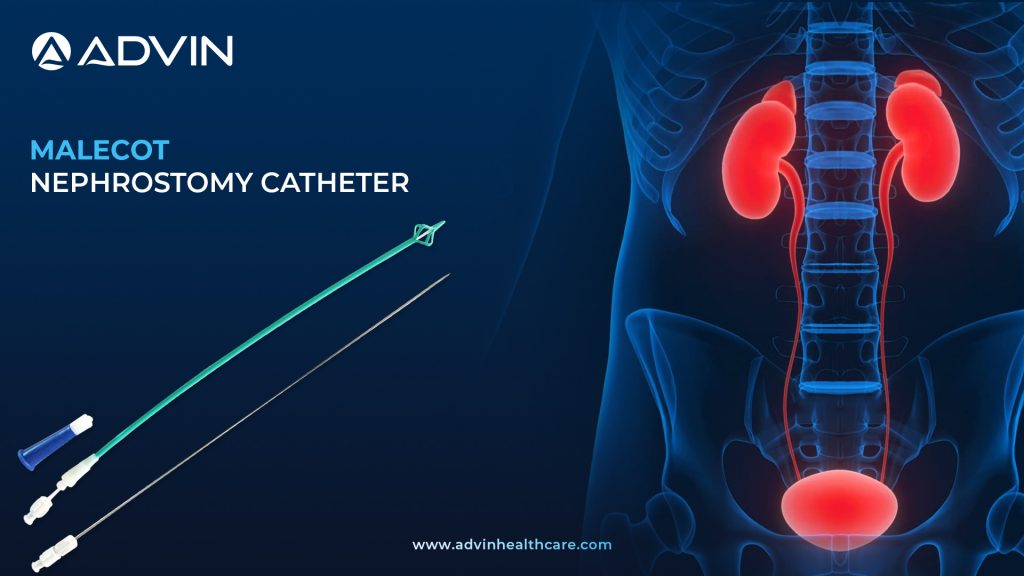 Malecot Nephrostomy Catheter – Secure Drainage with Winged Retention Design