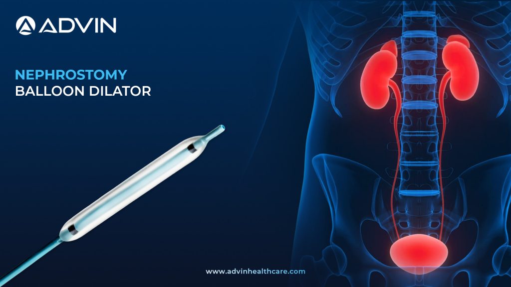 Nephrostomy Balloon Dilator: Precision Dilation for PCNL Procedures