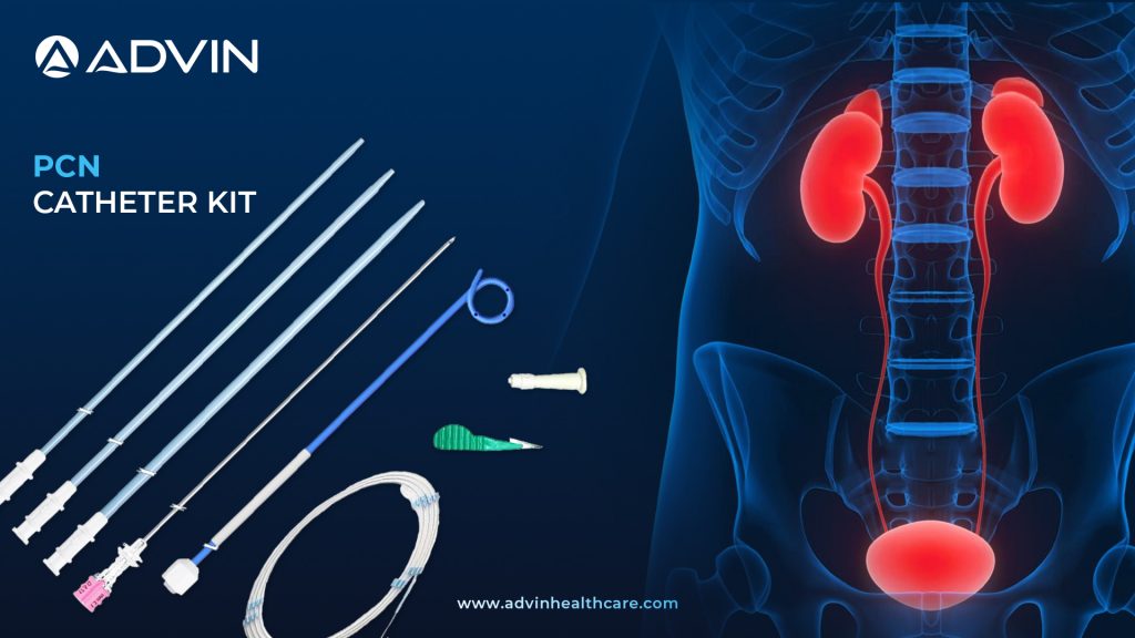 PCN Catheter Kit – Complete Solution for Safe Renal Drainage Procedures