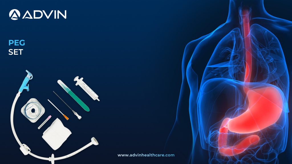 A Comprehensive Guide to the Percutaneous Endoscopic Gastrostomy (PEG) Set