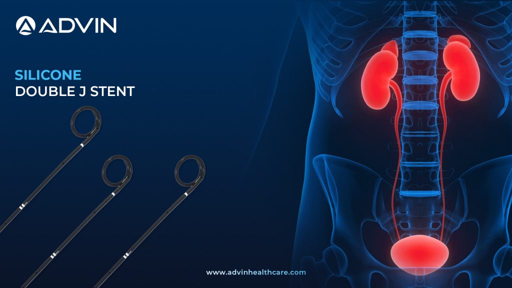Silicon Double J Stent – Flexible and Biocompatible Solution for Ureteral Drainage