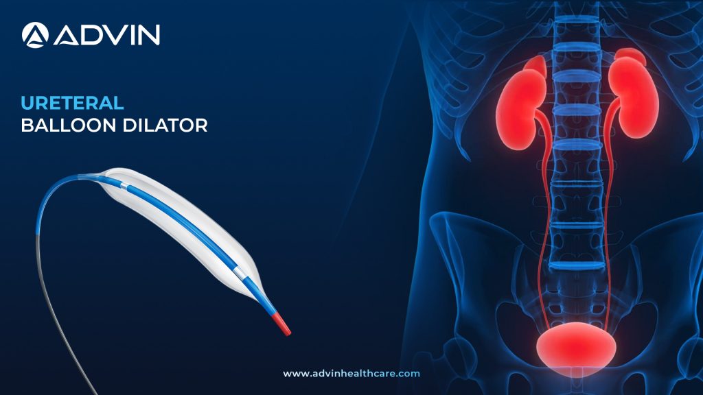 Ureteral Balloon Dilator – Precise Dilation for Ureteral Stricture Management