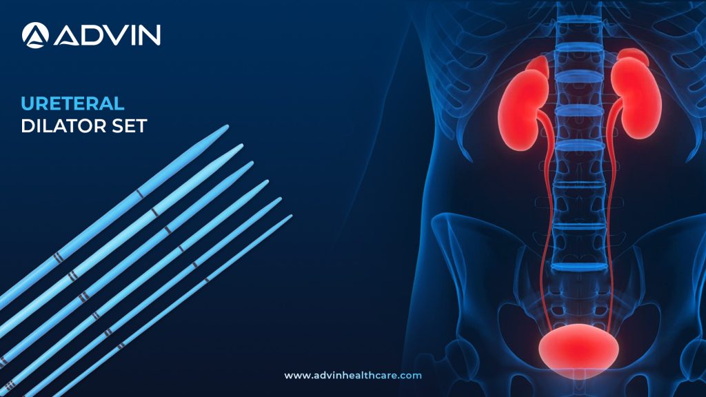 Ureteral Dilator Set – Essential Tool for Safe and Precise Ureteral Dilation