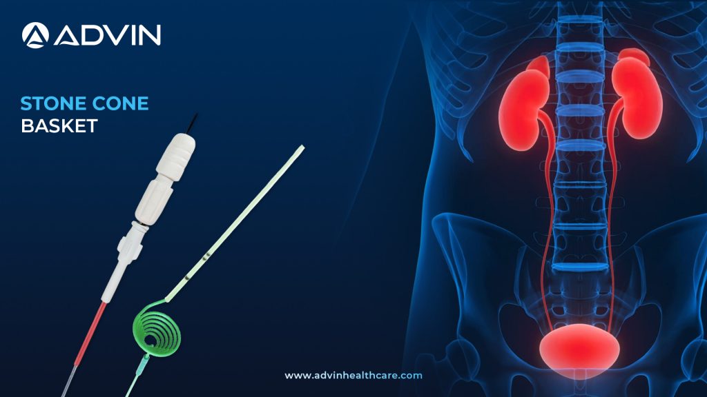 Stone Cone Basket – Prevent Stone Migration During Urological Procedures