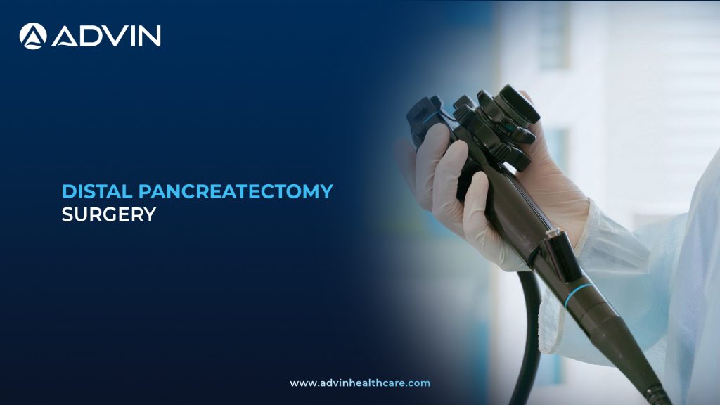Surgical Removal of the Pancreas Tail – Distal Pancreatectomy