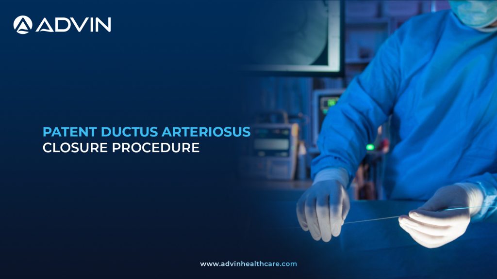 Patent Ductus Arteriosus (PDA) Closure – A Minimally Invasive Heart Repair