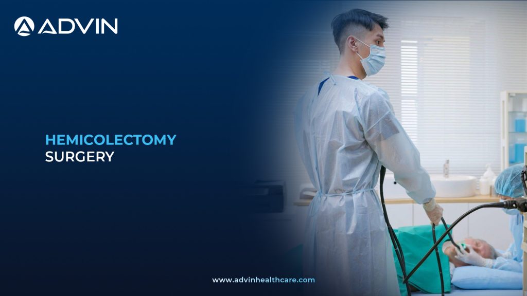 Hemicolectomy Surgery – A Colon Resection Approach